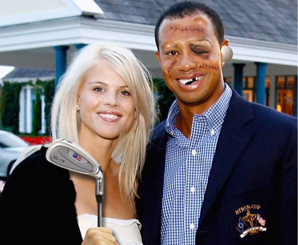 Tiger Woods Beat up by His