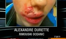 Marco Scandella’s Cheap Shot Leaves Alexandre Durette’s Face Battered
