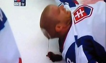 Vicious Hit Leaves Slovak Player Unconscious, Bloodied (Video)
