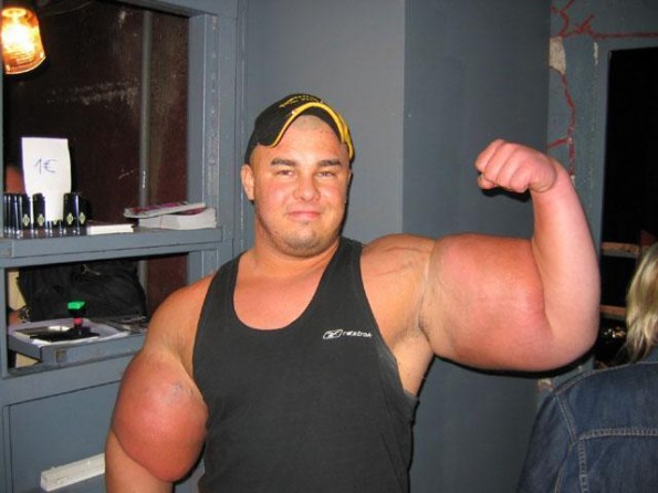 Synthol addict - all girls will admire him