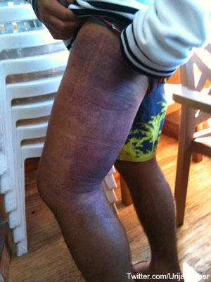 fabers-swollen-leg.jpg