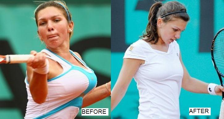 Smaller Breasts Not Yet Translating Into Bigger Wins For Simona Halep