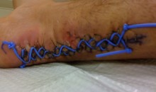 Achilles Shoelace (Pic)