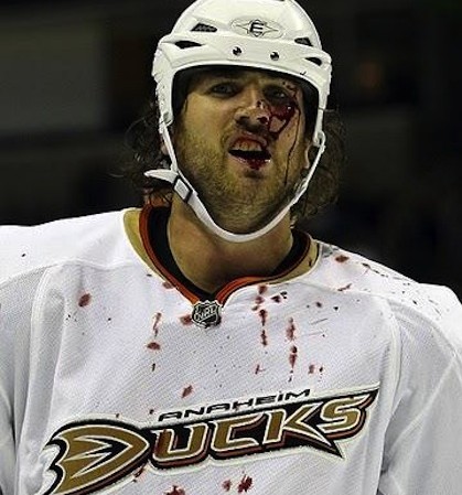 aaron voros bloody hockey face