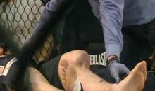 Watch The Most Disgusting Knee Injury In MMA History (Video)