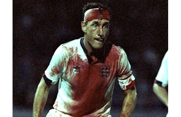terry-butcher-head-laceration-1989-most-gruesome-sports-injuries.jpg