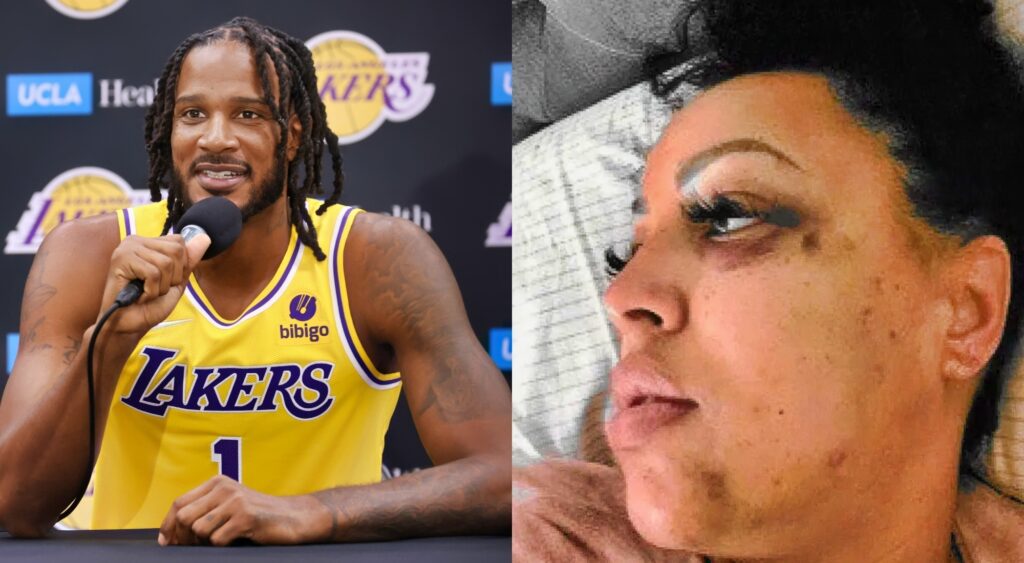 Photo of Trevor Ariza speaking to reporters and photo of his estranged wife Bree with bruises to her face