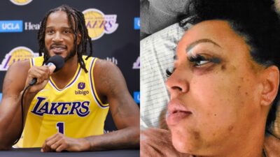 Photo of Trevor Ariza speaking to reporters and photo of his estranged wife Bree with bruises to her face