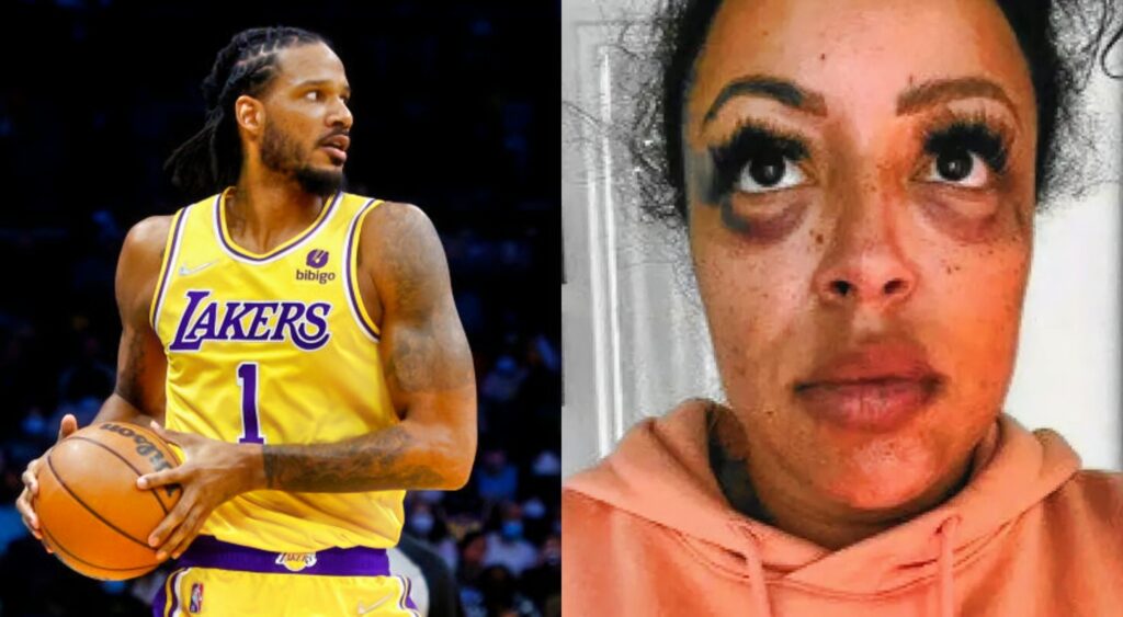Trevor Ariza in Lakers uniform. Other photo shows his bruised and battered wife