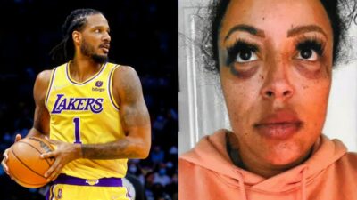 Trevor Ariza in Lakers uniform. Other photo shows his bruised and battered wife